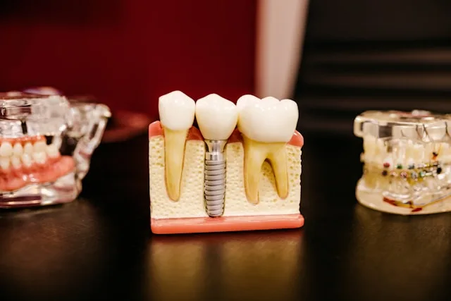 5 Simple Tips to Keep Your Smile Bright and White